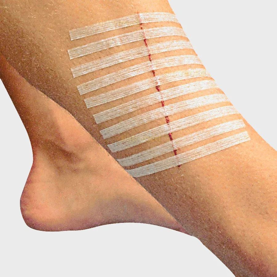 Wound Skin Closures, Reinforced