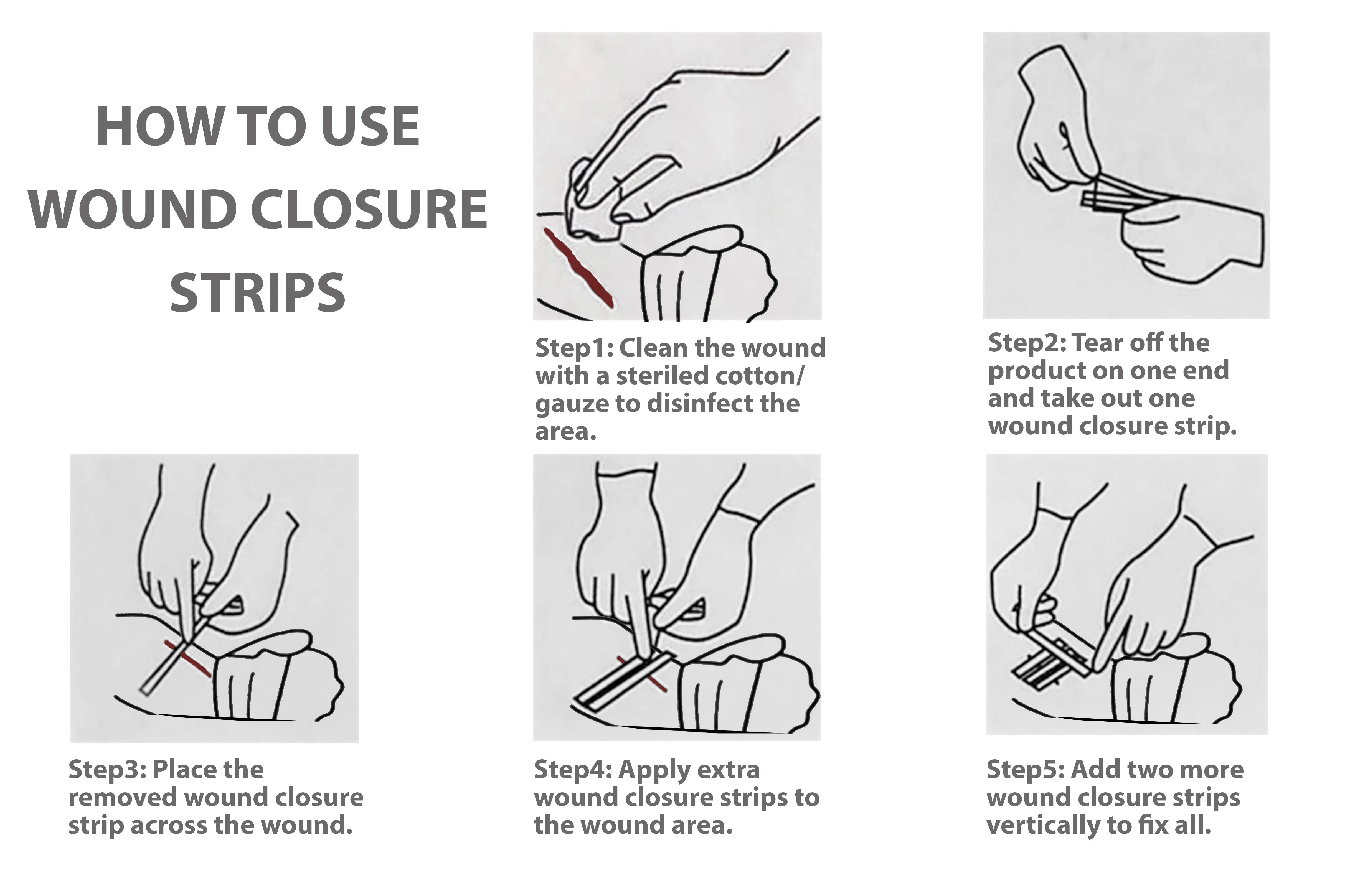 Wound Skin Closures, Reinforced